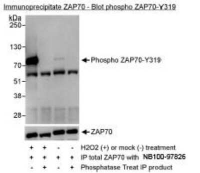 Immunoprecipitation: ZAP70 [p Tyr319] Antibody [NBP1-18896] - Jurkat WC Lysate treated with hydrogen peroxide (+) or mock treated (-). NB100-97826 was used to IP ZAP70. The IPs were either treated with phosphatase (+) or mock (-) treated.